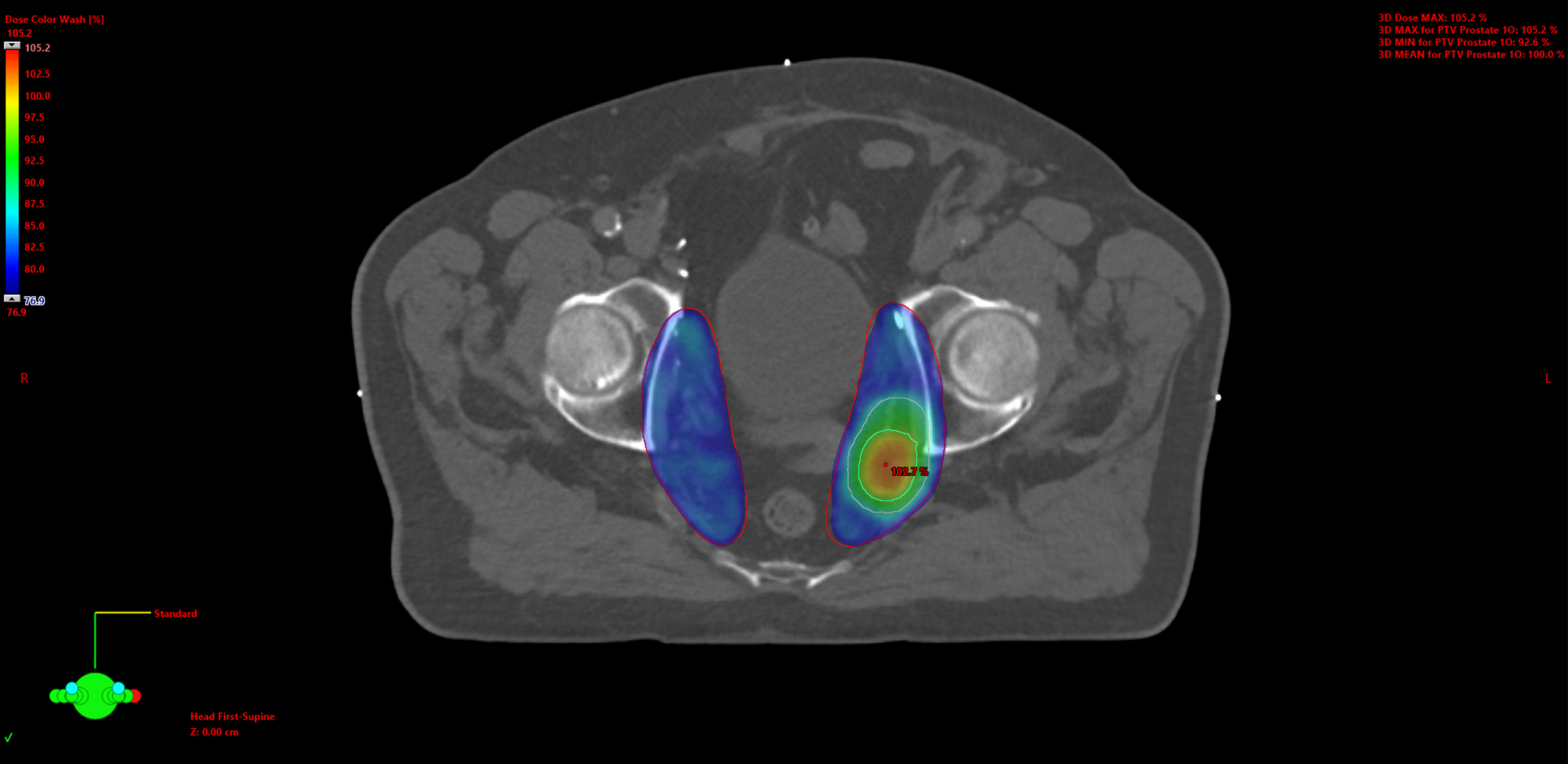 Medical Dosimetry Services