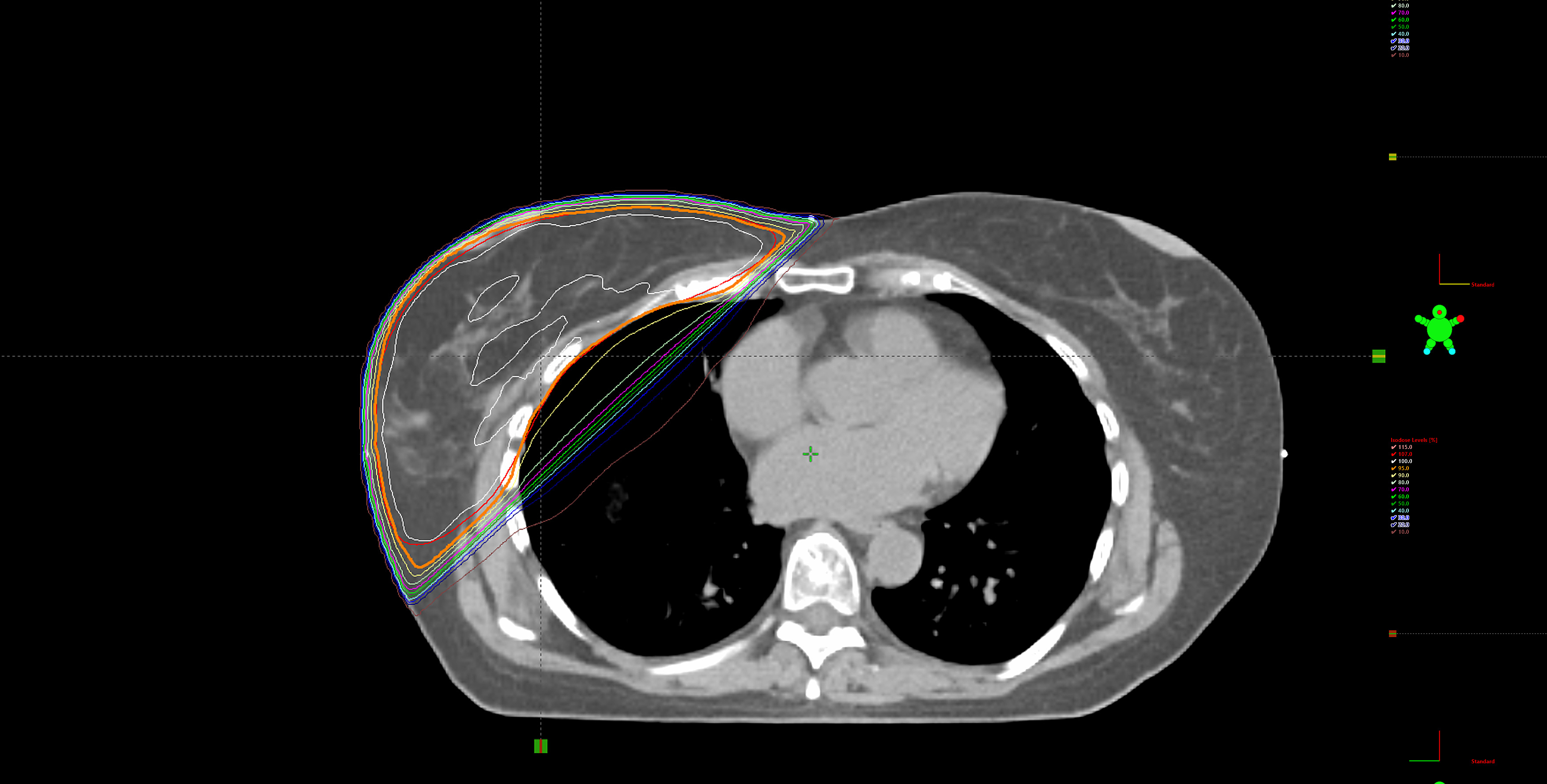 Medical Dosimetry Services